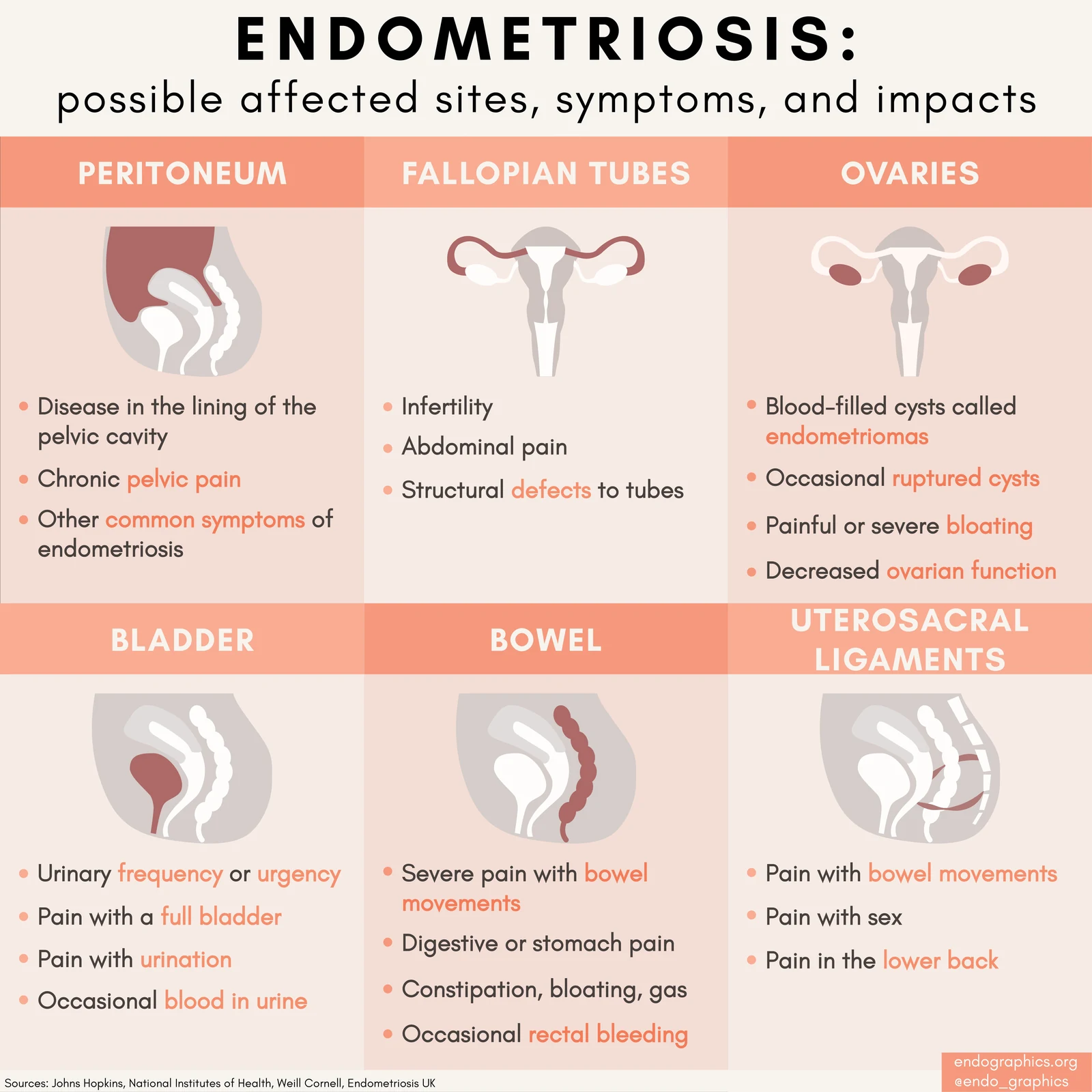 Infographic titled Endometriosis: possible affected sites, symptoms, and impacts. It covers the peritoneum, fallopian tubes, ovaries, bladder, bowel, and uterosacral ligaments.