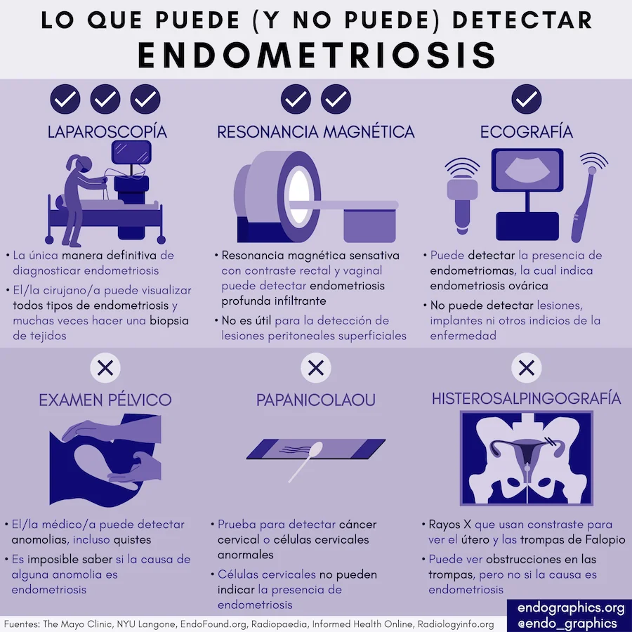 Lo que puede y no puede detectar endometriosis. Infografía sobre laparoscopía, resonancia magnética, ecografía, examen pélvico, papanicolaou e histerosalpingografía