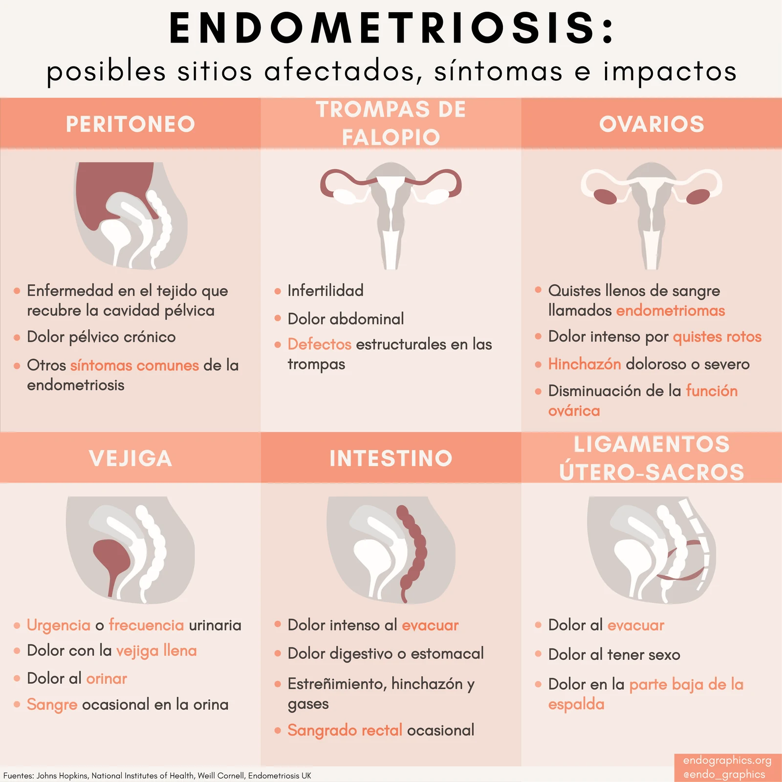 Infografía titulada Endometriosis: posibles sitios afectados, síntomas e impactos. Cubre el peritoneo, las trompas de Falopio, los ovarios, la vejiga, el intestino y los ligamentos útero-sacros.